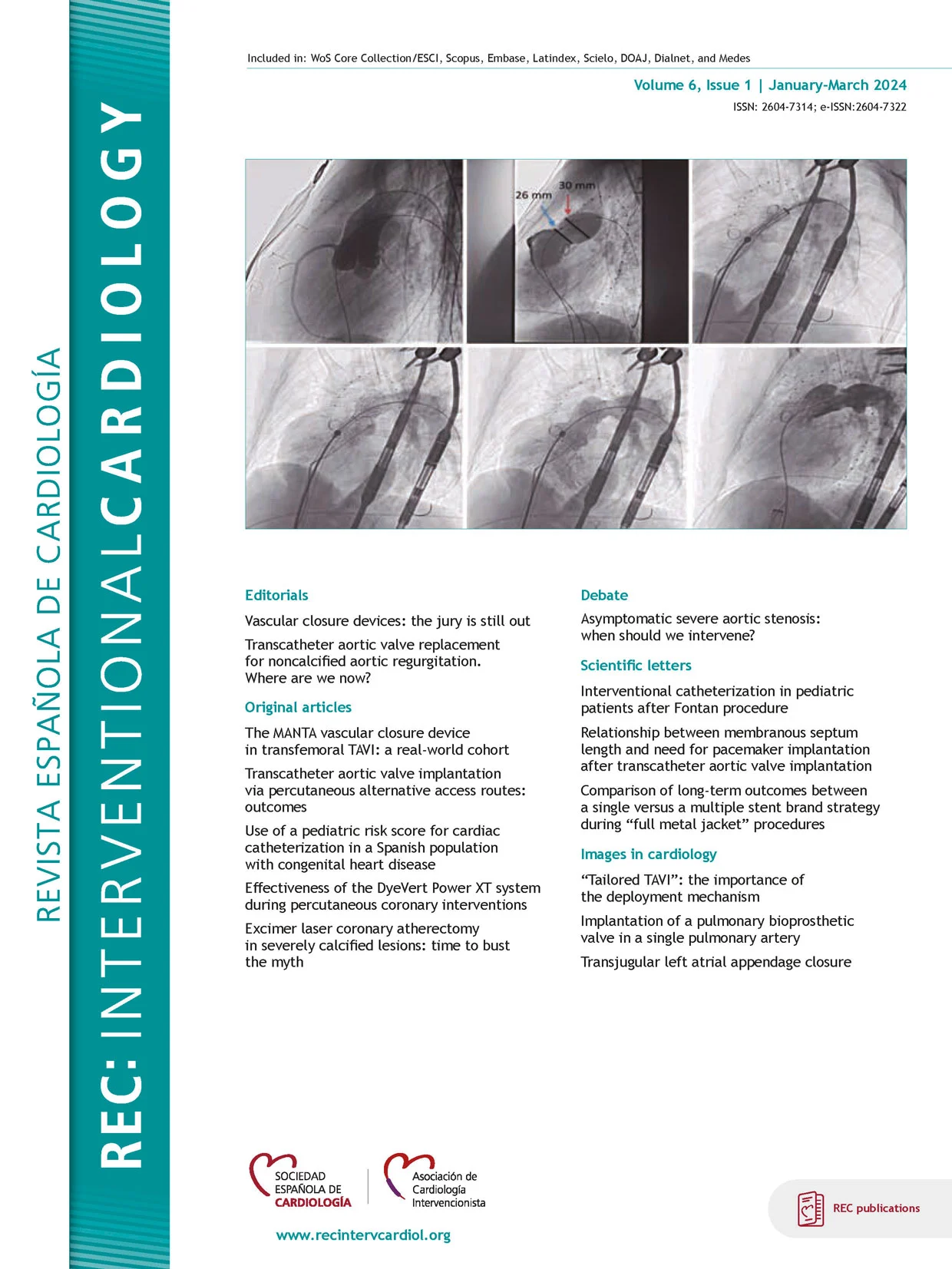 Revista Española de Cardiología Revista Española de Cardiología