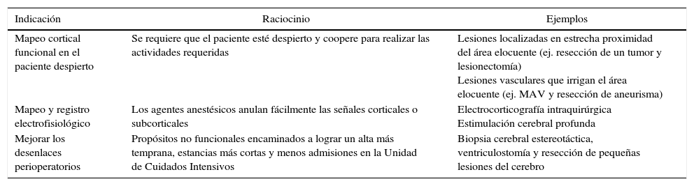 Tablas