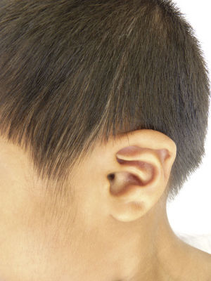 Pabellones auriculares con hélix doblado.