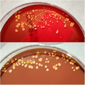 Culture after incubation for 5 days.